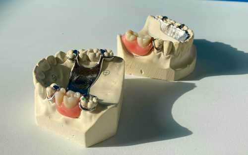 Partial Dentures